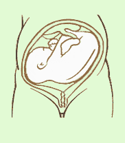 ماذا يحدث اذا لم يتخذ الجنين الوضع الطبيعى للولادة Fetal_transverselie