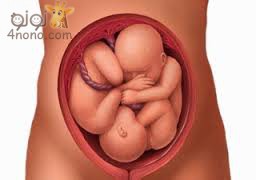 ماذا يحدث اذا لم يتخذ الجنين الوضع الطبيعى للولادة Images-43