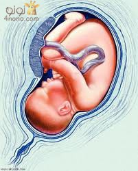 ماذا يحدث اذا لم يتخذ الجنين الوضع الطبيعى للولادة Images-53