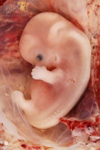 ينغرس الجنين الرحم يثبت الحمل